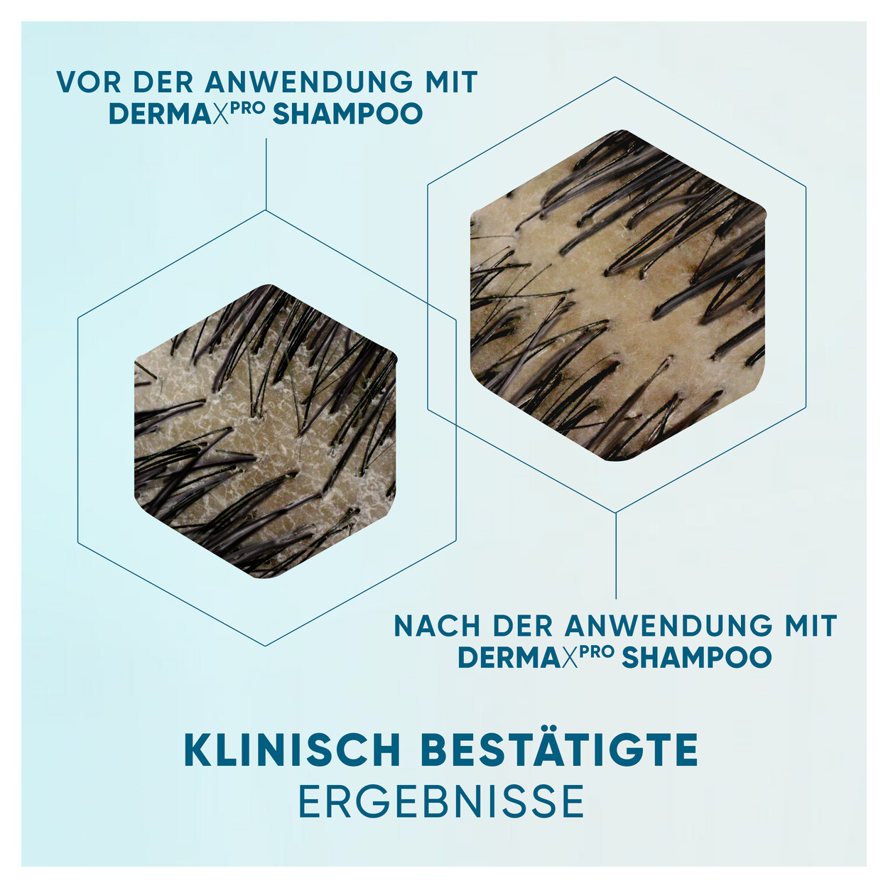 Head & Shoulders DermaXPro Anti-Schuppen-Shampoo Aloe Vera-Extrakt