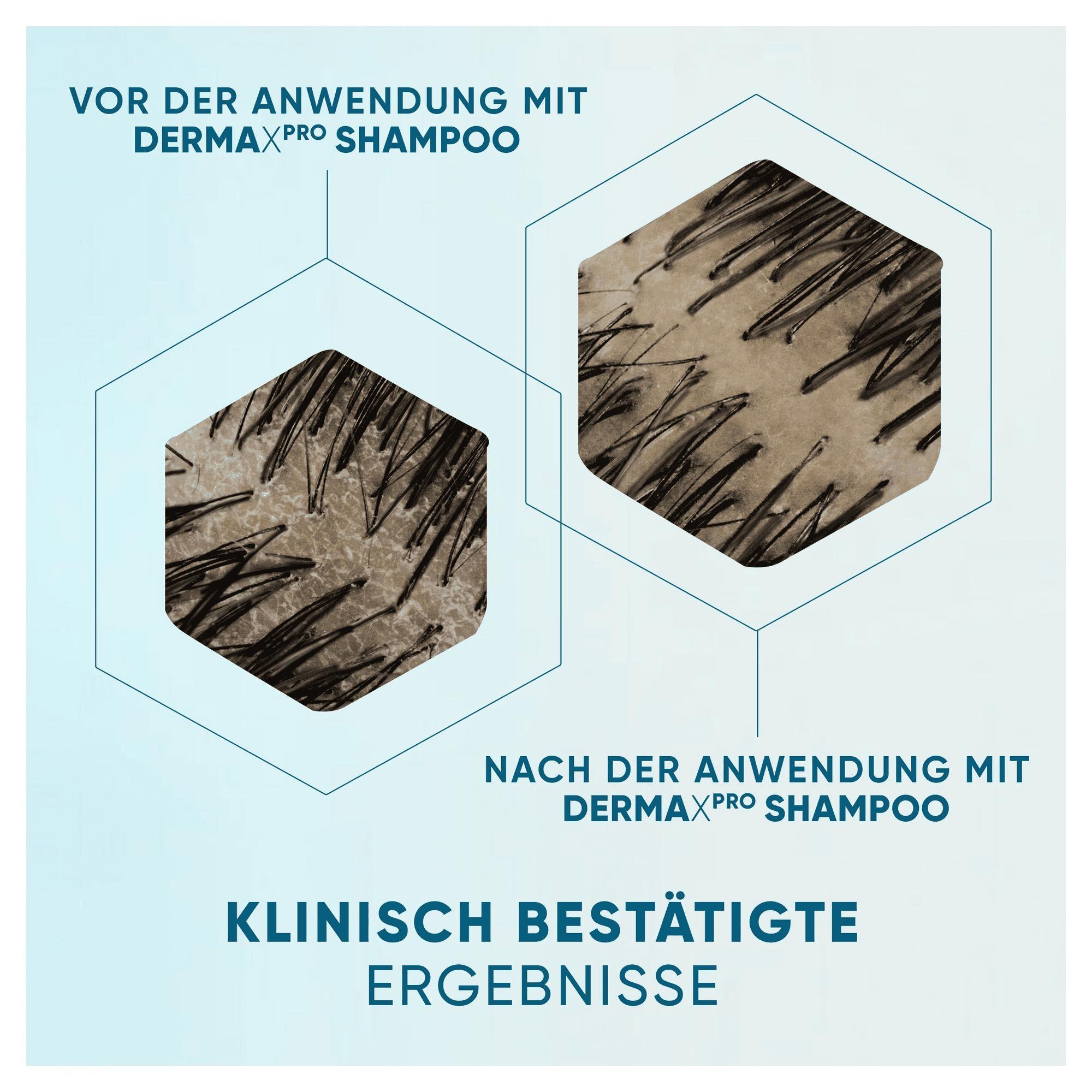 Head & Shoulders DermaXPro Anti-Schuppen-Shampoo Aloe Vera-Extrakt